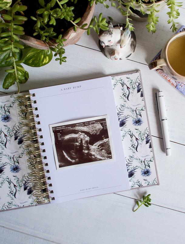 Write To Me- Bump. My Pregnancy Journey